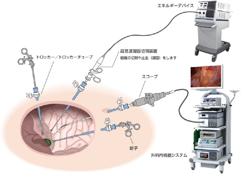 内視鏡・腹腔鏡外科手術